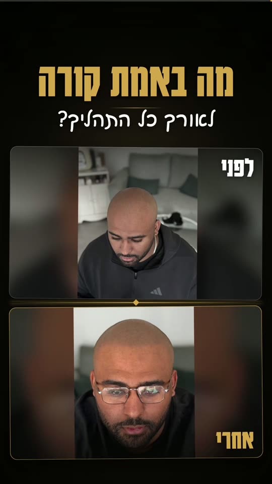 קורן | תהליך הטיפול