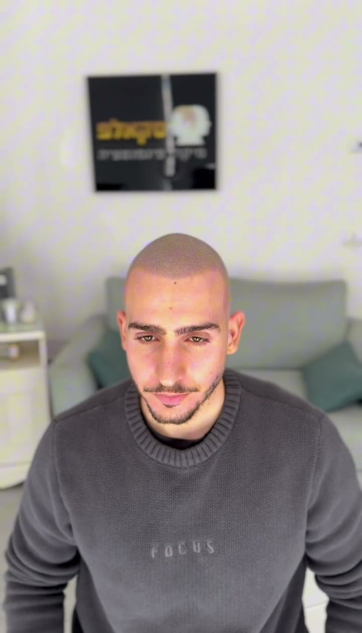 לקוח סקאלפ מול המראה, לפני ואחרי הדמיית שיער